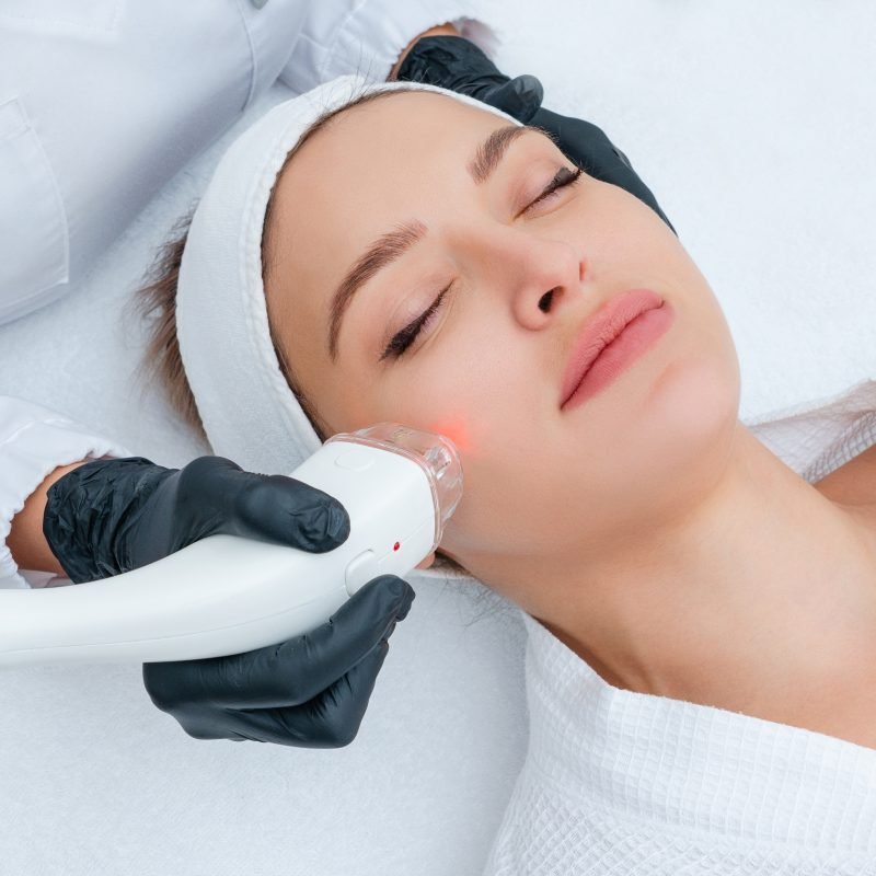 Young woman receiving laser treatment in cosmetology clinic